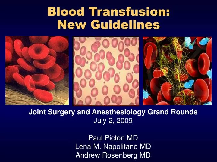 blood transfusion new guidelines