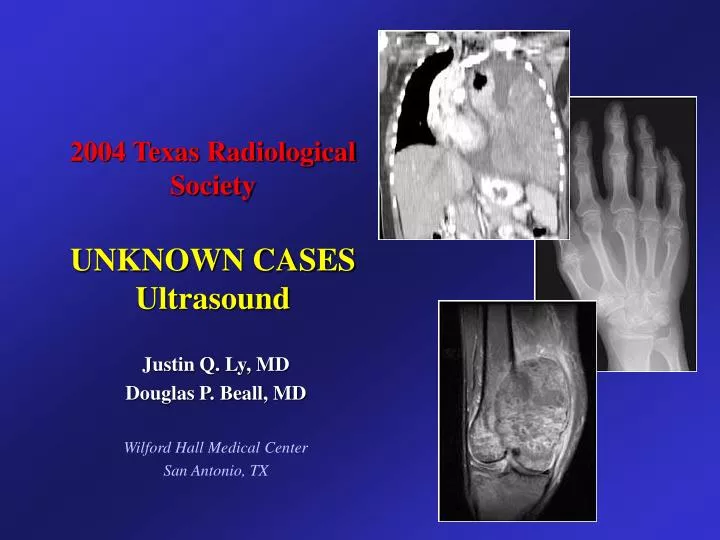 2004 texas radiological society unknown cases ultrasound