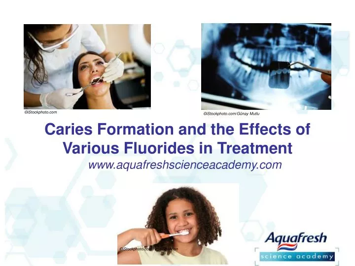 caries formation and the effects of various fluorides in treatment
