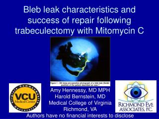Bleb leak characteristics and success of repair following trabeculectomy with Mitomycin C