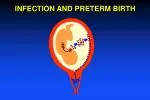 INFECTION AND PRETERM BIRTH