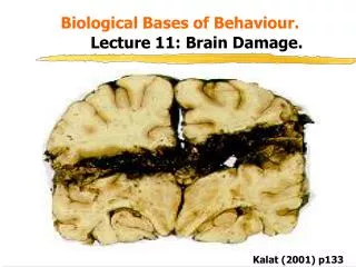 Biological Bases of Behaviour. Lecture 11: Brain Damage.