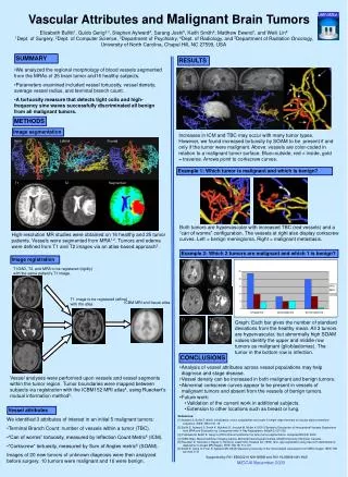 Vascular Attributes and Malignant Brain Tumors