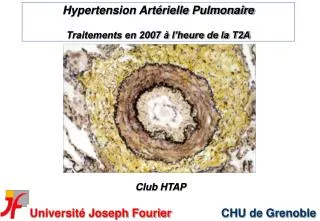 Hypertension Artérielle Pulmonaire Traitements en 2007 à l’heure de la T2A