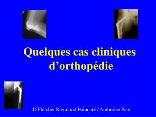 Quelques cas cliniques d’orthopédie