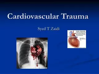 Cardiovascular Trauma