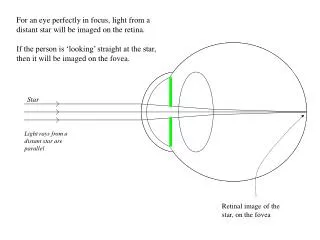 For an eye perfectly in focus, light from a distant star will be imaged on the retina.