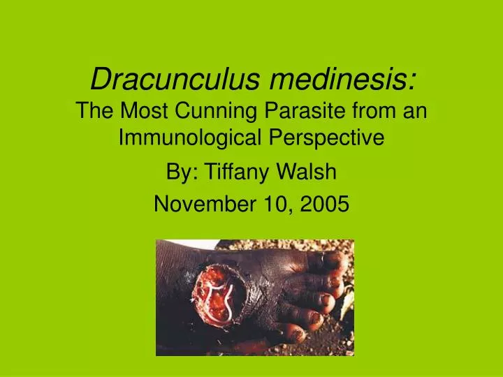 dracunculus medinesis the most cunning parasite from an immunological perspective