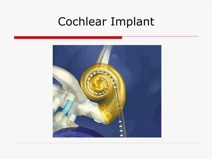 cochlear implant