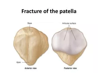 Fracture of the patella