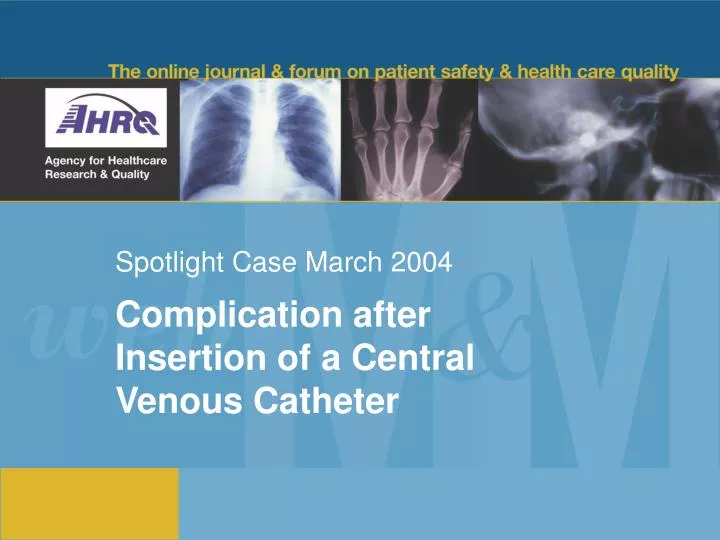 spotlight case march 2004