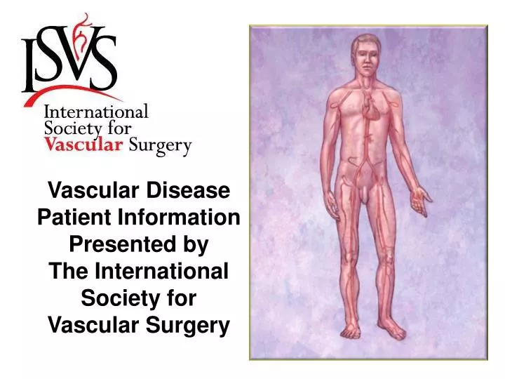 vascular disease patient information presented by the international society for vascular surgery