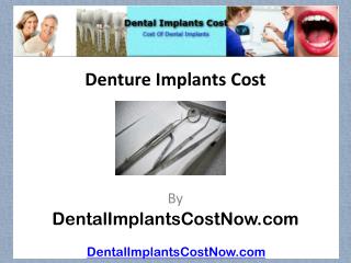 Denture Implants Cost