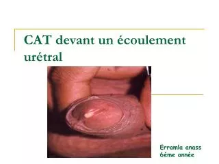 CAT devant un écoulement urétral