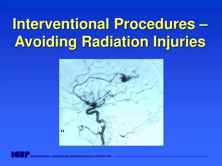 interventional procedures avoiding radiation injuries