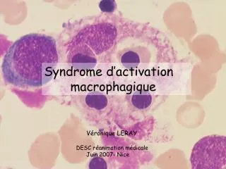 Syndrome d’activation macrophagique