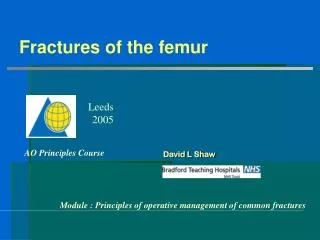 Fractures of the femur