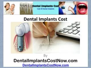 [Dental Implants Cost]