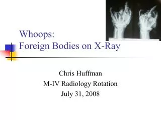Whoops: Foreign Bodies on X-Ray