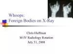 Whoops: Foreign Bodies on X-Ray - slide 1
