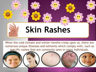 Frequent Winter Rashes and Skin Disorders - Fully grasp Some