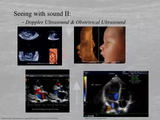 Seeing with sound II: 	- Doppler Ultrasound &amp; Obstetrical Ultrasound