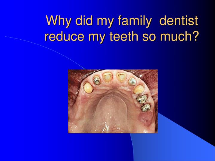 why did my family dentist reduce my teeth so much