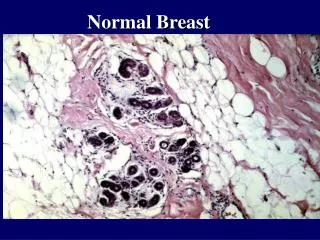 Normal Breast