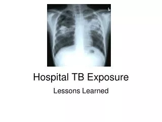 Hospital TB Exposure