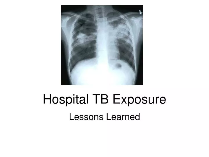 hospital tb exposure