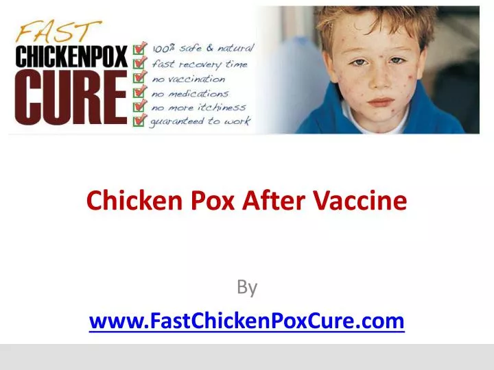 chicken pox after vaccine