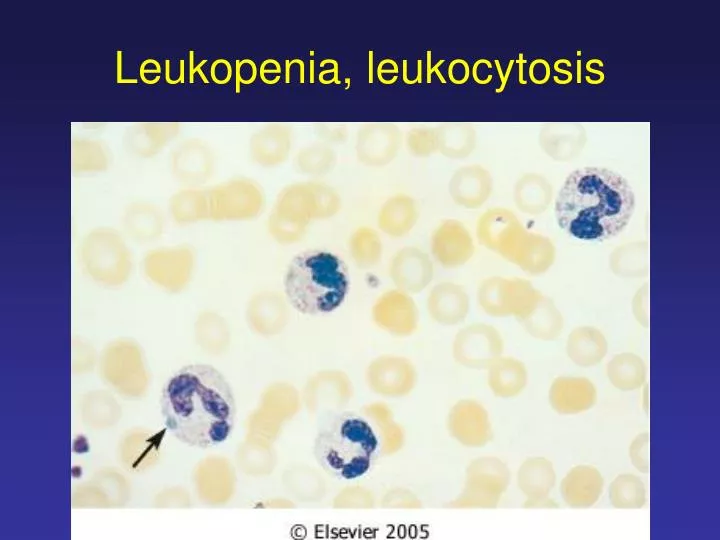 leukopenia leukocytosis