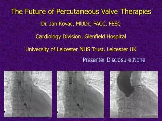 Dr. Jan Kovac, MUDr., FACC, FESC Cardiology Division, Glenfield Hospital University of Leicester NHS Trust, Leicester UK