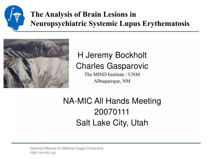 the analysis of brain lesions in neuropsychiatric systemic lupus erythematosis