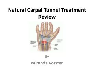 Natural Carpal Tunnel Treatment Review
