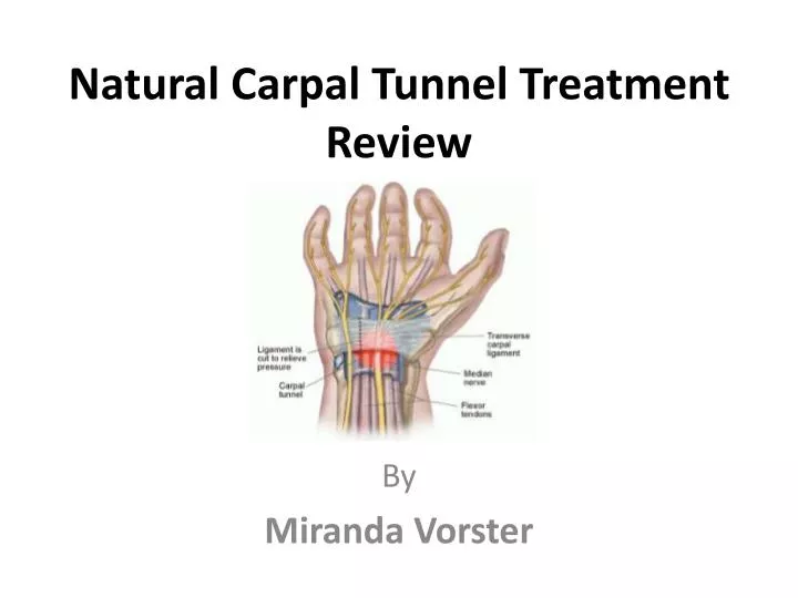 natural carpal tunnel treatment review