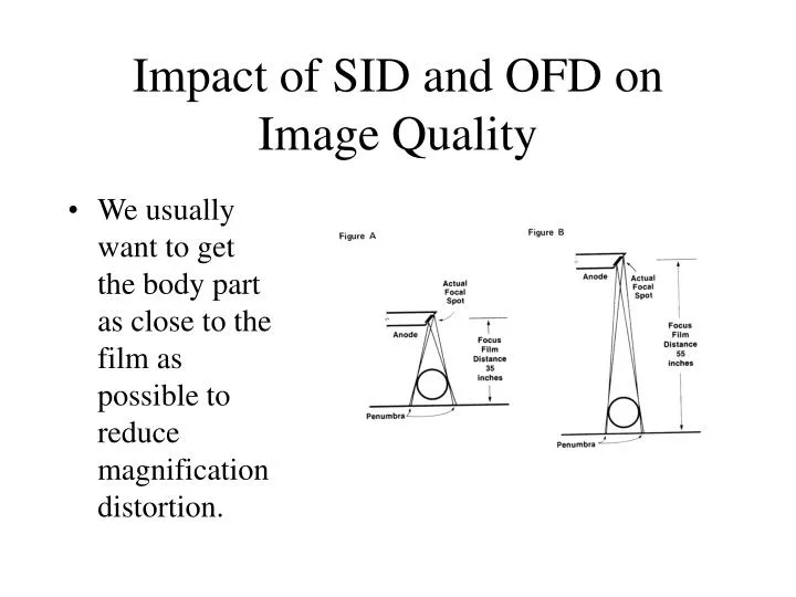 impact of sid and ofd on image quality