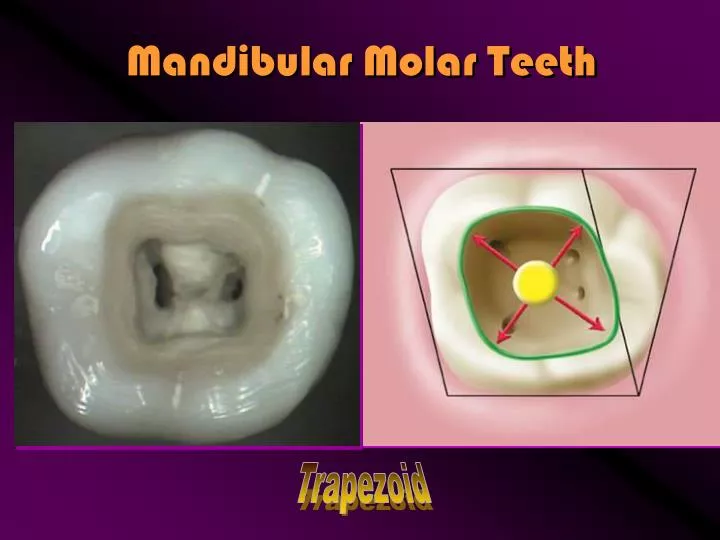 mandibular molar teeth