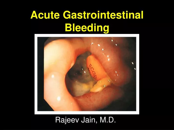 acute gastrointestinal bleeding