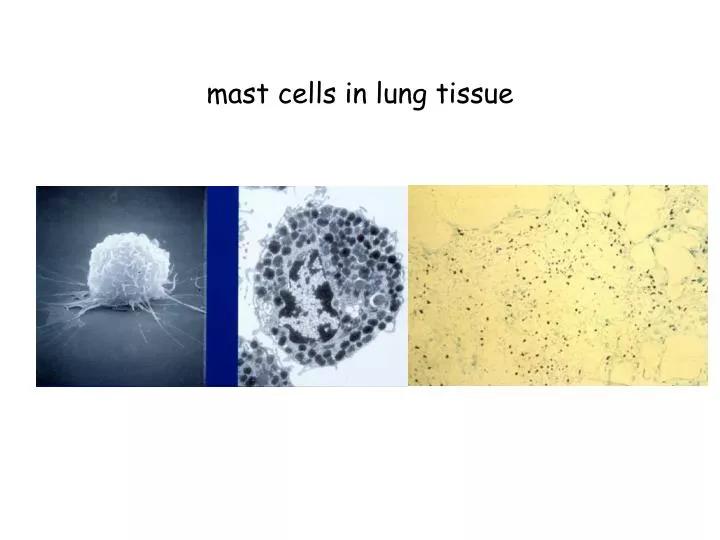 mast cells in lung tissue