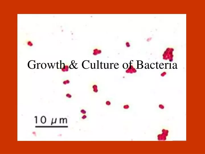 growth culture of bacteria