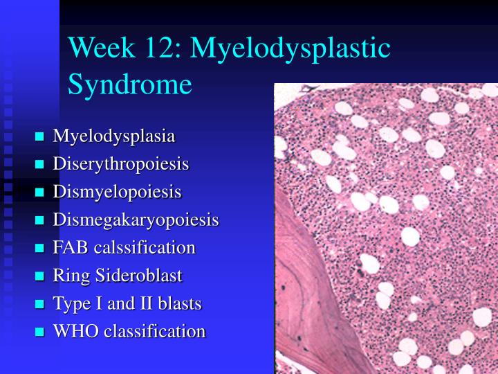 week 12 myelodysplastic syndrome