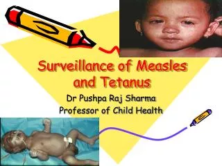 Surveillance of Measles and Tetanus