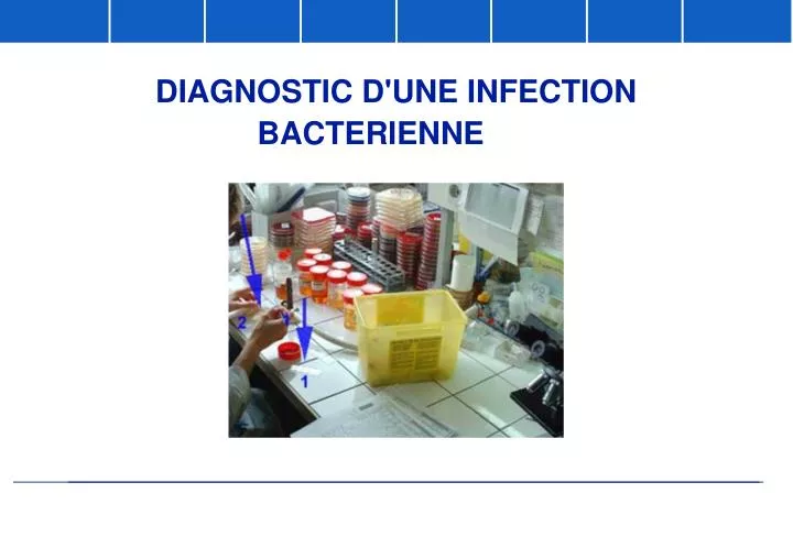 diagnostic d une infection bacterienne