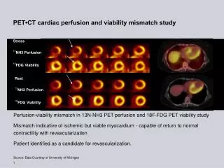 PET•CT cardiac perfusion and viability mismatch study
