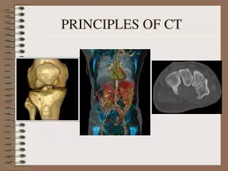 PRINCIPLES OF CT