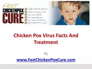 Chicken Pox Virus Facts And Treatment