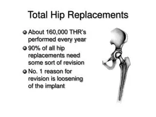 Total Hip Replacements