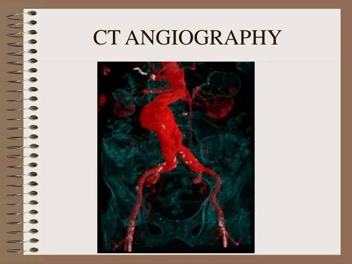 ct angiography