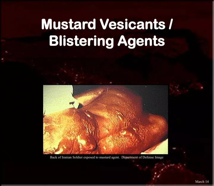 mustard vesicants blistering agents